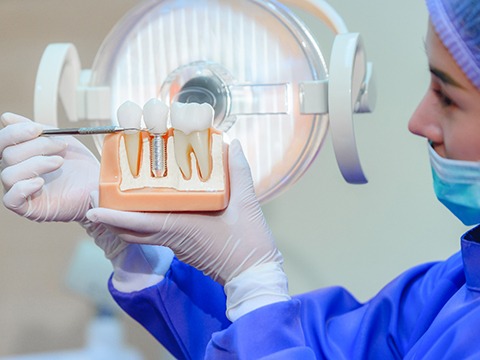 model of a dental implant being shown to the patient
