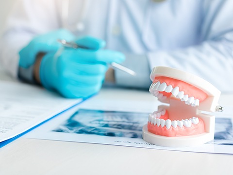  Artificial teeth on desk where dentist is looking over X-ray