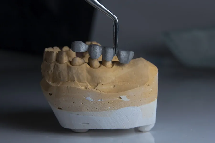 Dental tweezers placing a tooth restoration on a plaster model