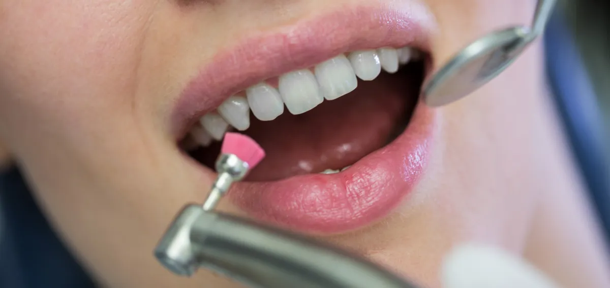 Dental Cleanings - General & Family Dentistry at Dentique Dental Care