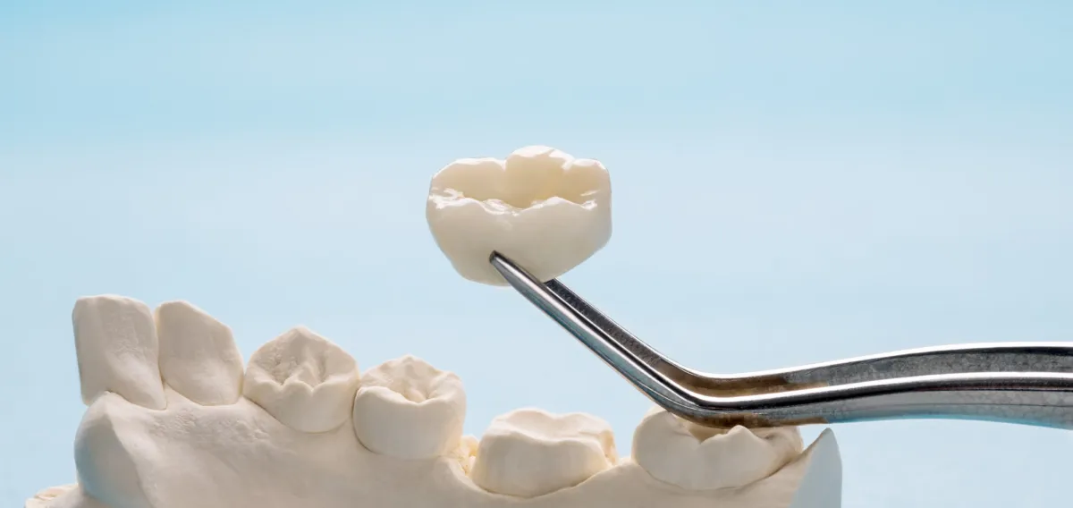 Dental Crown - Restorative Dentistry Treatment at Dentique Dental Care