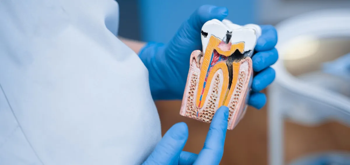 Root Canal Therapy - Restorative Dentistry Treatment at Dentique Dental Care