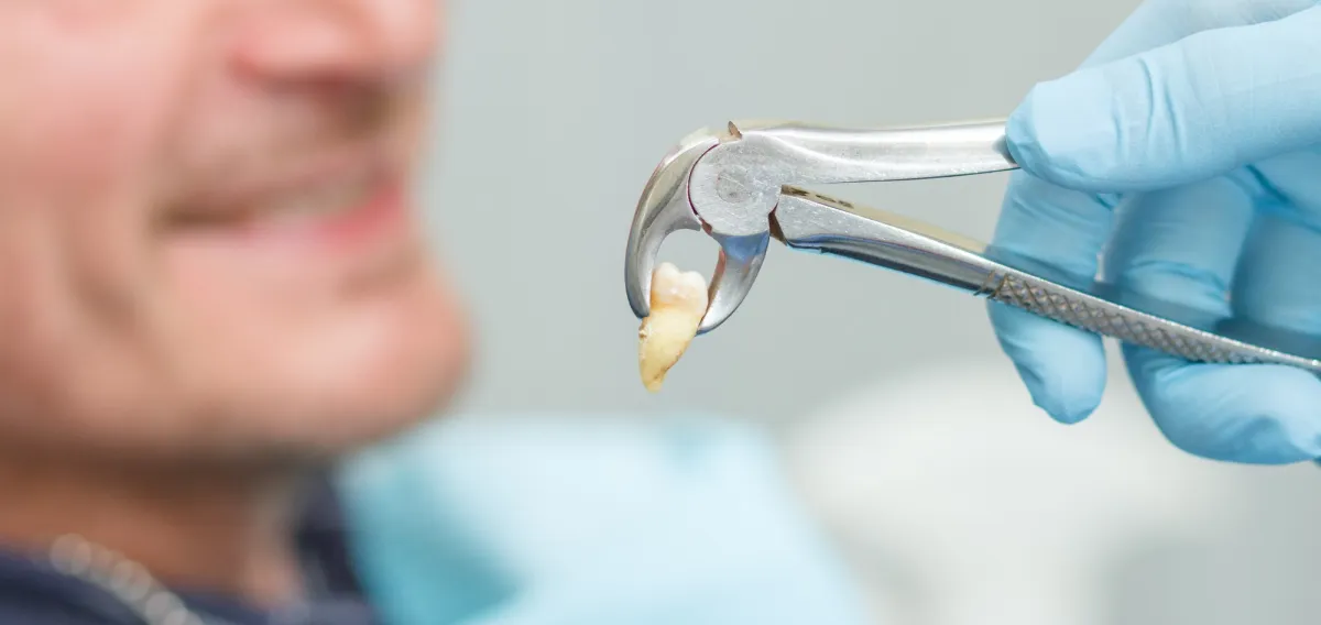 Tooth Extractions - Oral Surgery Treatments at Dentique Dental Care