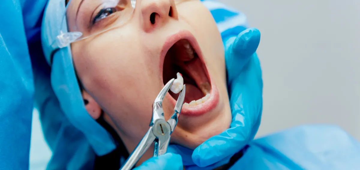 Wisdom Teeth Removal - Oral Surgery Treatments at Dentique Dental Care