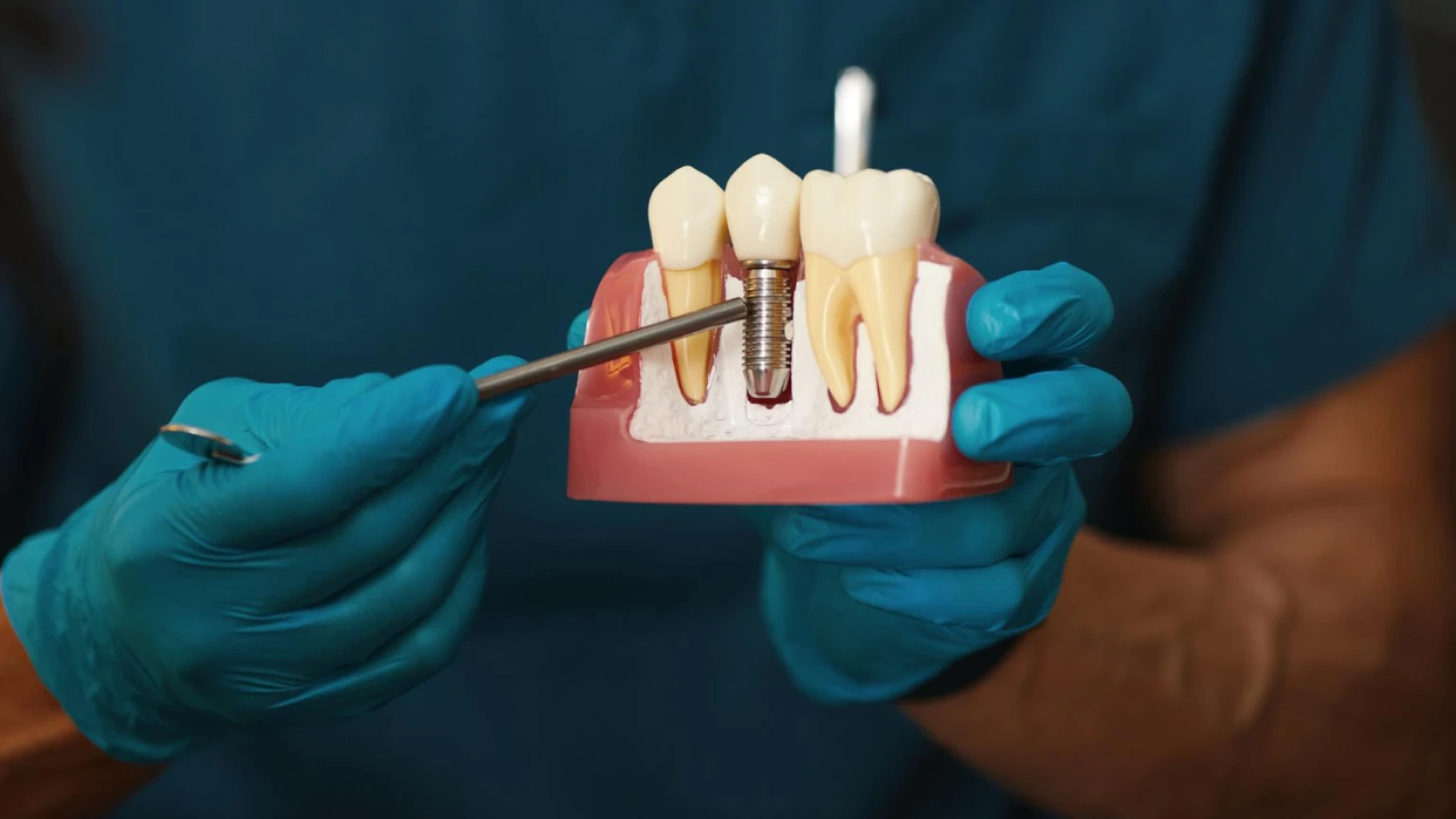 Dental Implants Cost in Illinois — a dentist explaining dental implant costs to a patient in an Illinois dental clinic