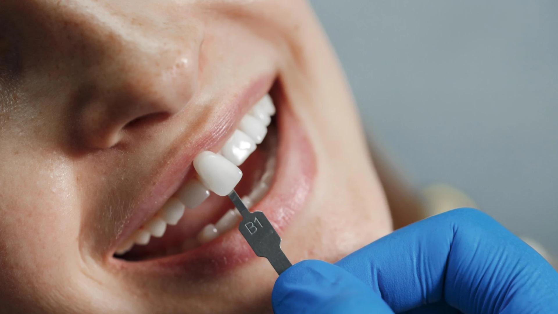 5732 What Are Dental Implants — And Why Theyre Worth the - Dentique Dental Care