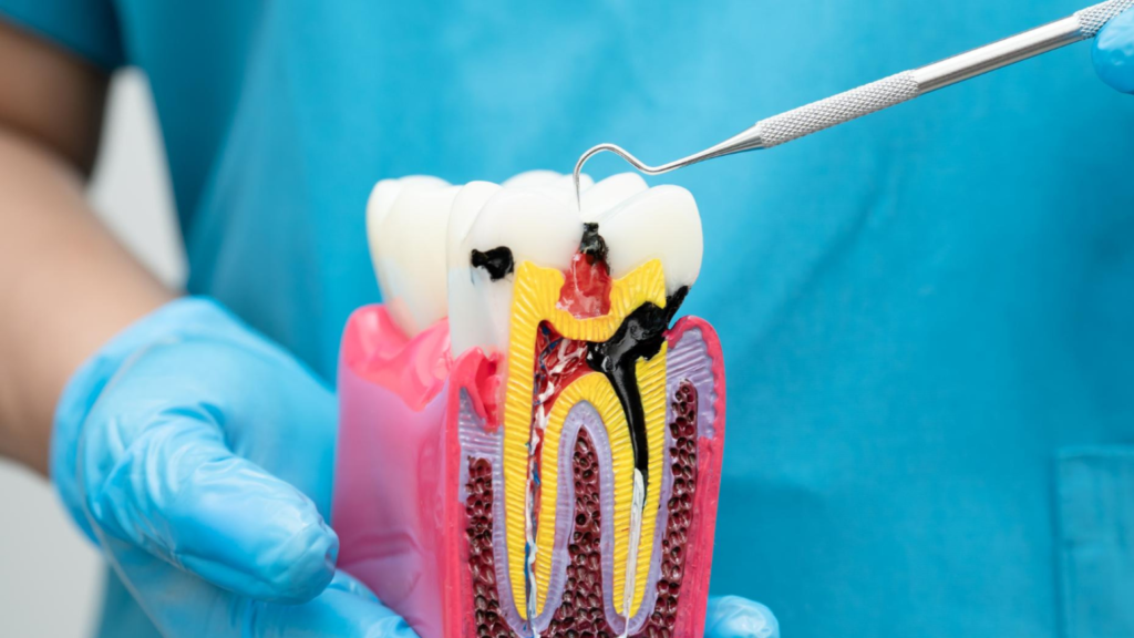 Does a Root Canal Hurt The Truth About Pain-Free Root Canals