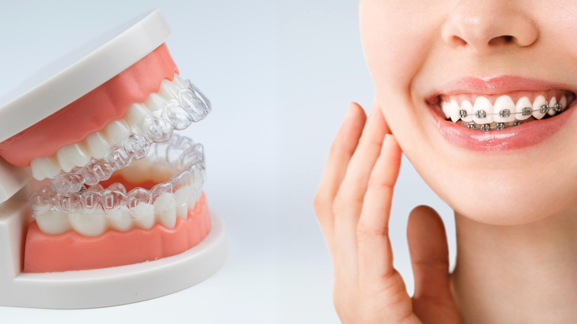 Invisalign vs Braces for Adults: Cost, Timeline & Comfort