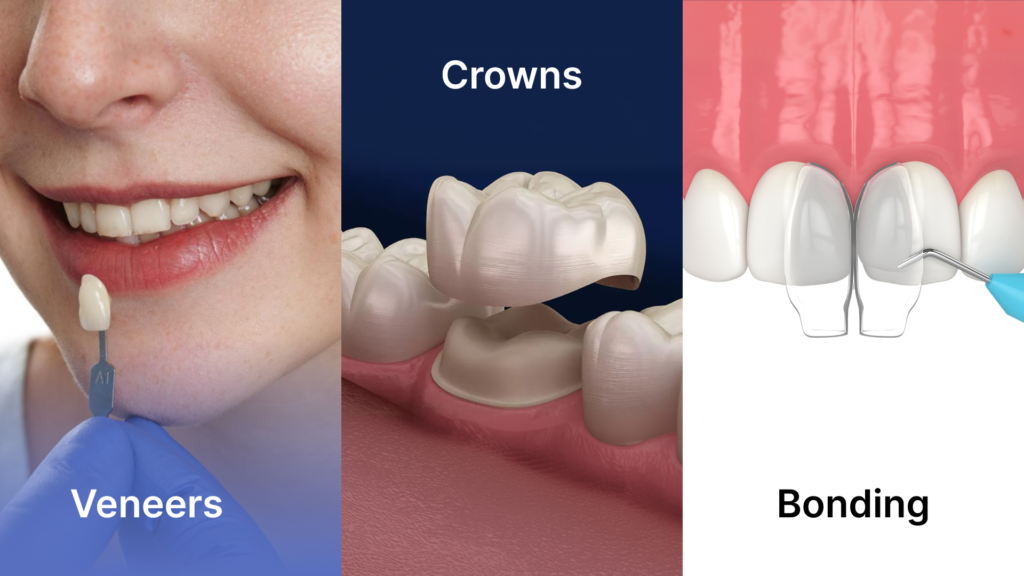 Veneers vs Crowns vs Dental Bonding – Choosing the Right Cosmetic Dentistry Treatment for Your Smile