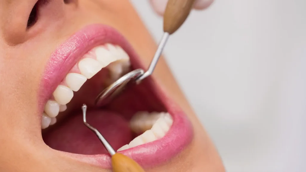 Deep Teeth Cleaning Scaling and Root Planing: What to Expect, Cost, and Recovery 8 - Dentique Dental Care Deep-Teeth-Cleaning-Scaling-and-Root-Planing-What-to-Expect-Cost-and-Recovery.