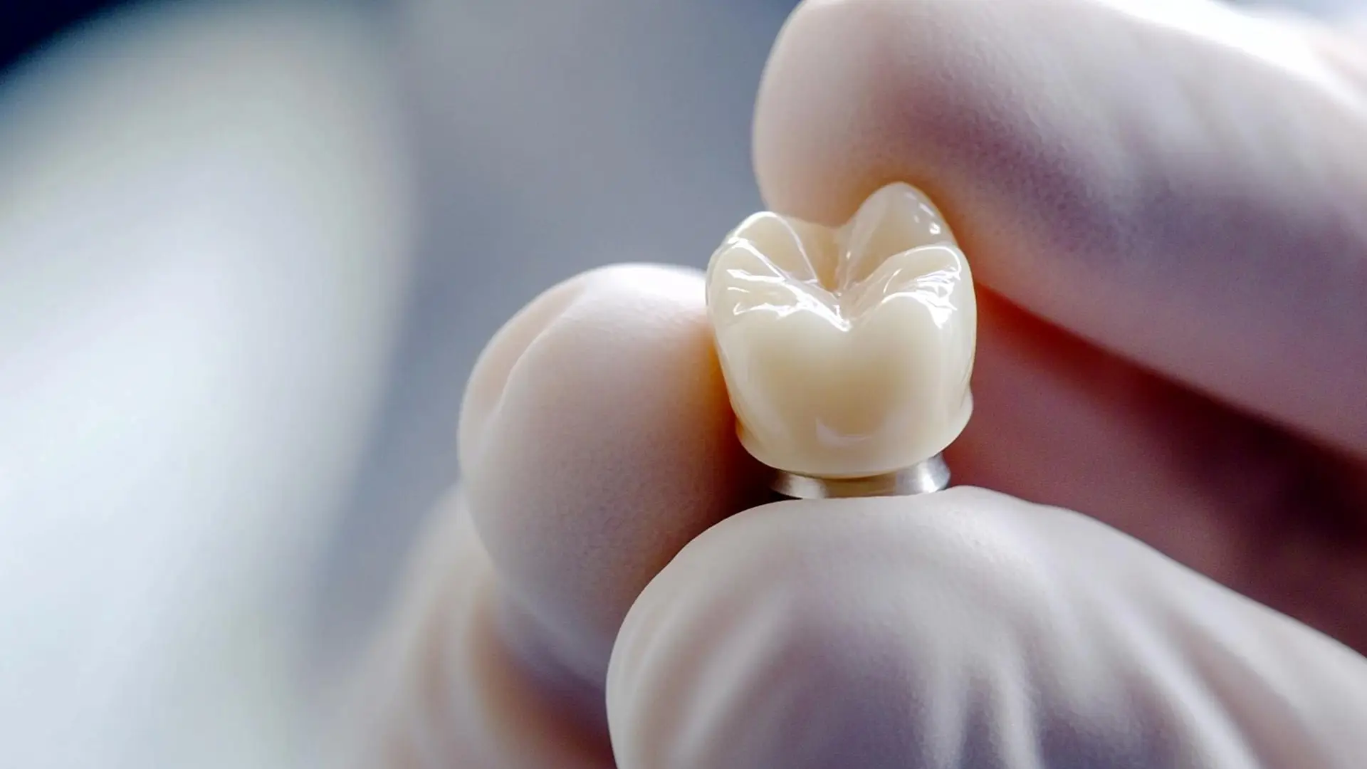 Dental-Crowns-Explained-Types-Materials-Cost-and-Same-Day-Options.webp