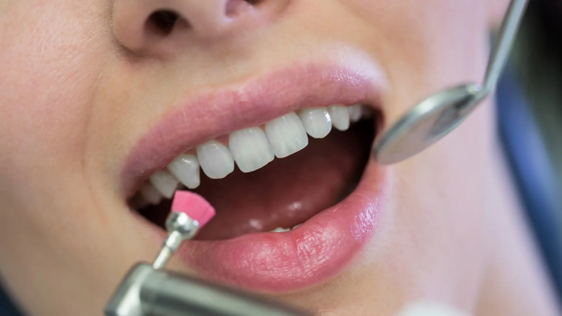 Teeth-Cleaning-Dental-Exams-How-Often-You-Really-Need-Them