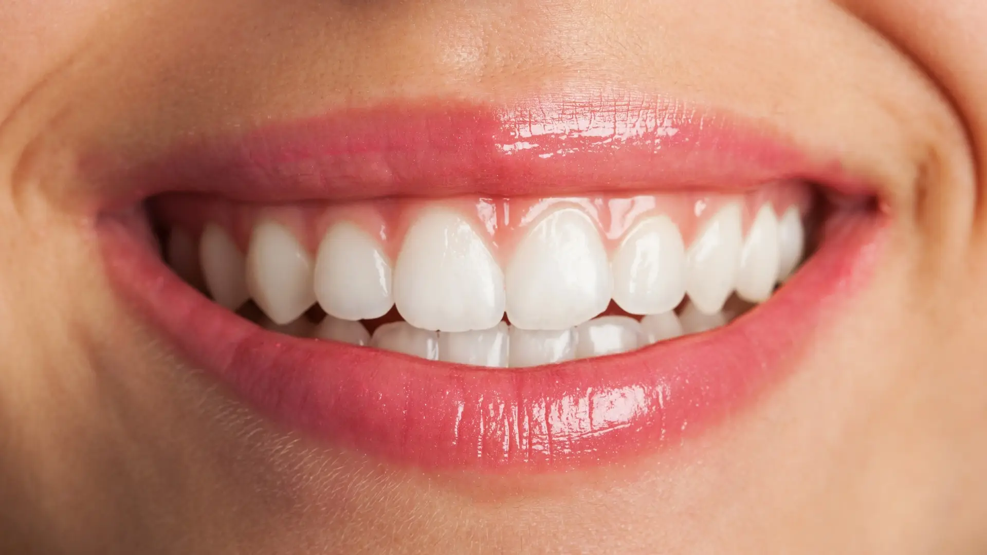Teeth-Whitening-in-Downers-Grove-In-Office-vs-At-Home-Options-and-Cost