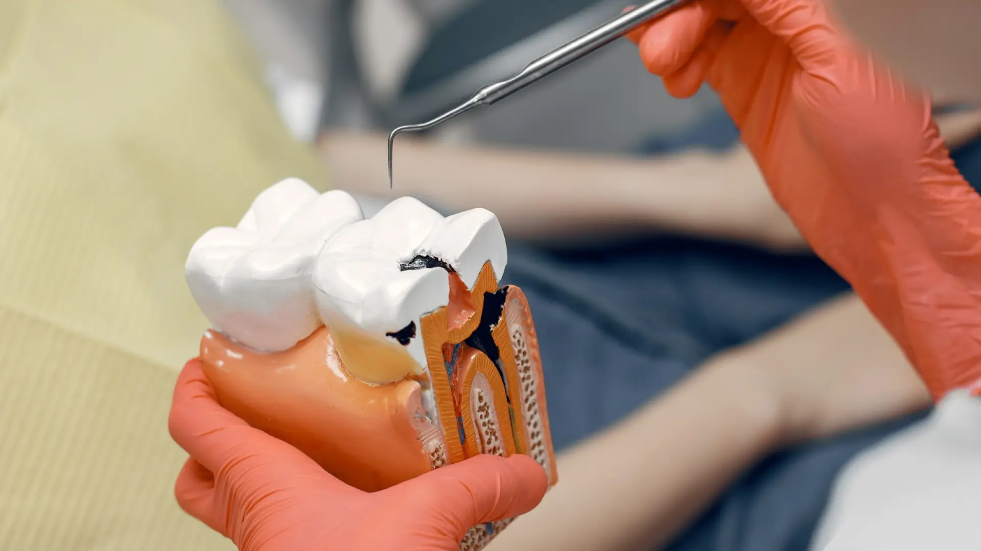 Tooth-Colored-vs-Amalgam-Fillings-Cost-Process-and-How-Long-They-Last